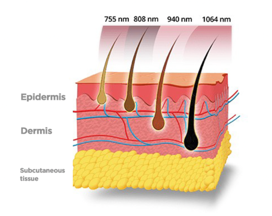 4D-tech-hair-removal