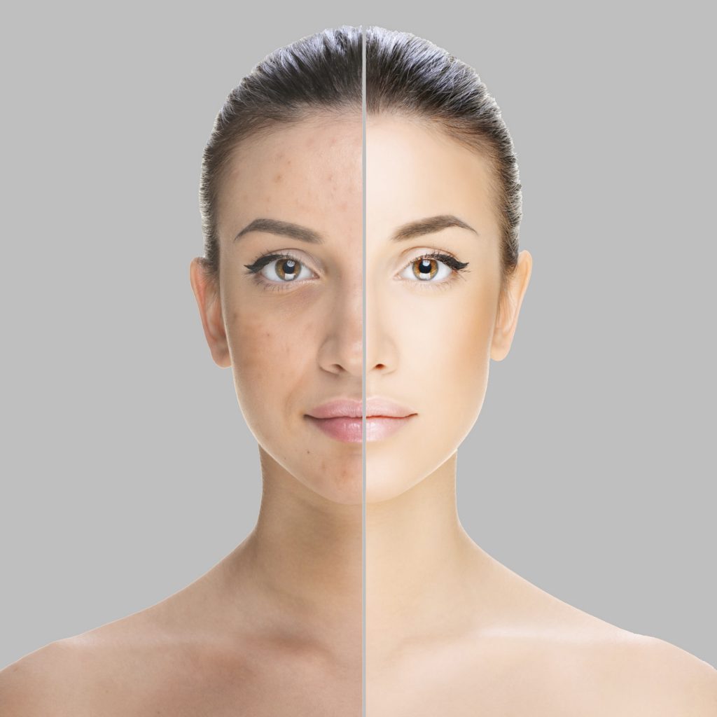 BRP-beforeandafter-1024×1024